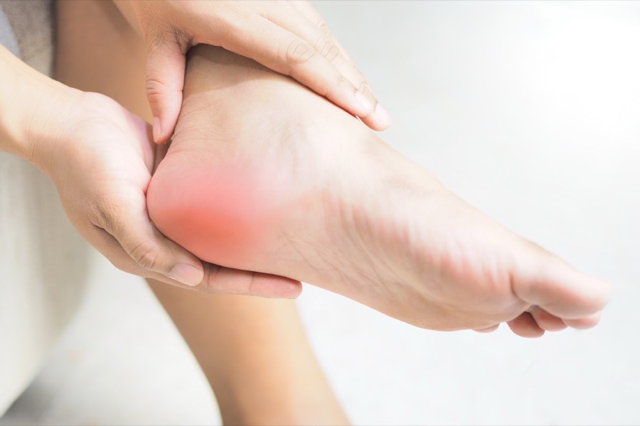 Acupuncture for Plantar Fasciitis