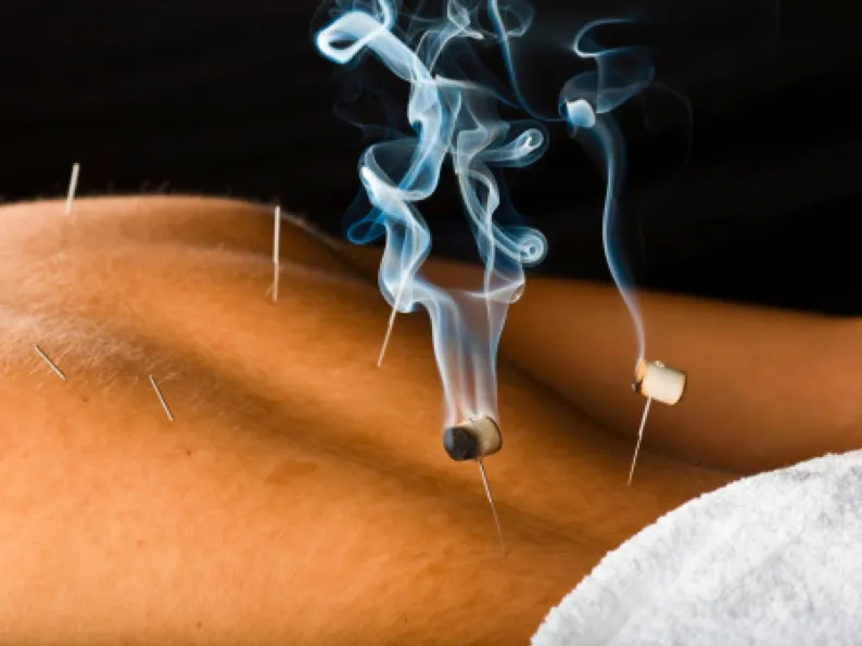 Warm needle moxibustion: moxa burns on the needle handle